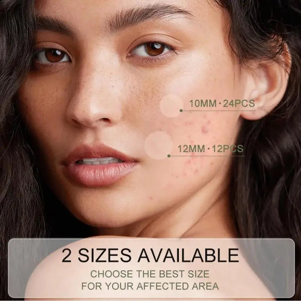 Acne Pimple Patch Invisível – Tratamento Rápido e Eficaz - BOLDORA