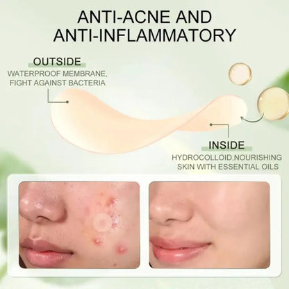 Acne Pimple Patch Invisível – Tratamento Rápido e Eficaz - BOLDORA
