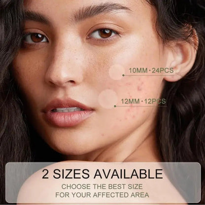 Acne Pimple Patch Invisível – Tratamento Rápido e Eficaz - BOLDORA