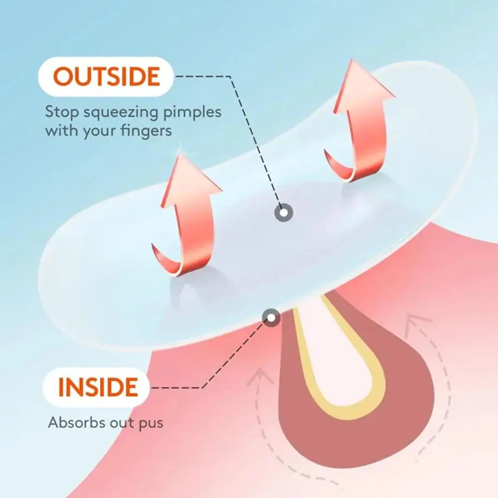Acne Pimple Patch Invisível – Tratamento Rápido e Eficaz - BOLDORA